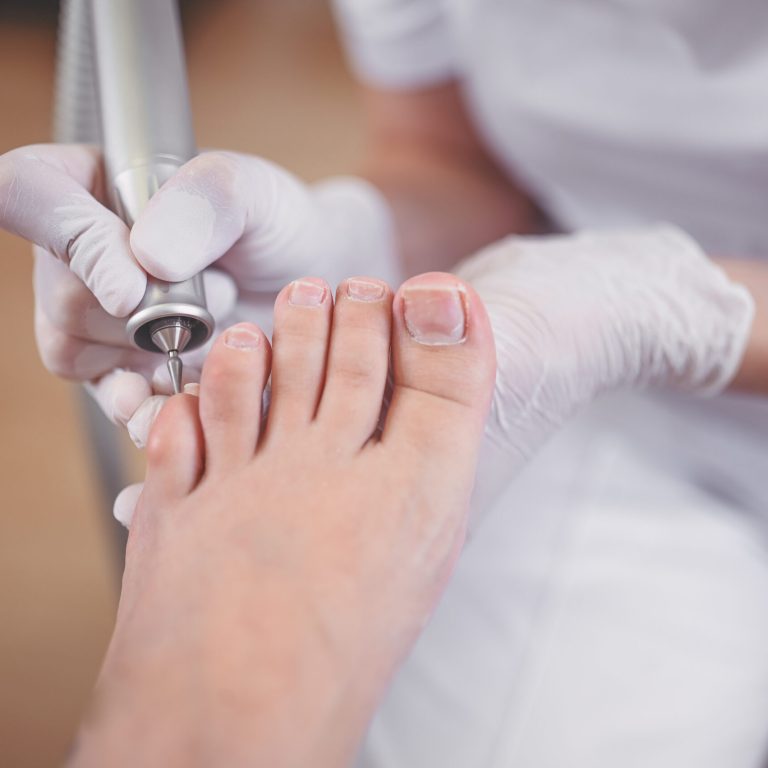 Hardware medical pedicure with nail file drill apparatus. Patient on pedicure treatment with pediatrician chiropodist. Foot peeling treatment at spa with a special device. Clinic of Podiatry Podology.